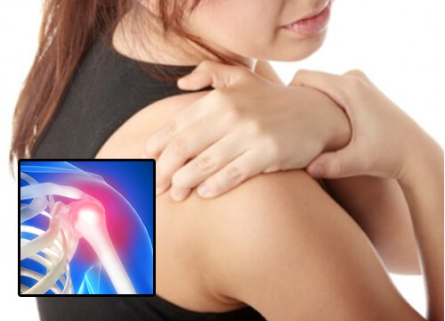 Schulterschmerzen: Vorsorge und Behandlung Schulterschmerzen: Vorsorge und Behandlung