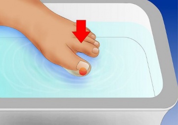 Wie werden eingewachsene Fußnägel behandelt?