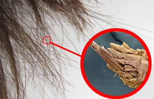 Spliss: natürliche Mittel gegen Haarspaltereien