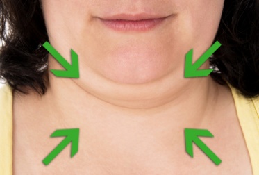 7 Tipps gegen Doppelkinn