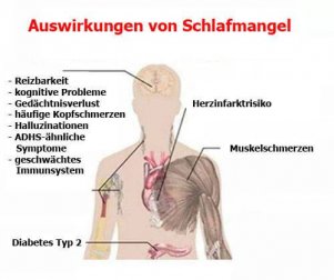 Ernste Folgen von Schlafmangel