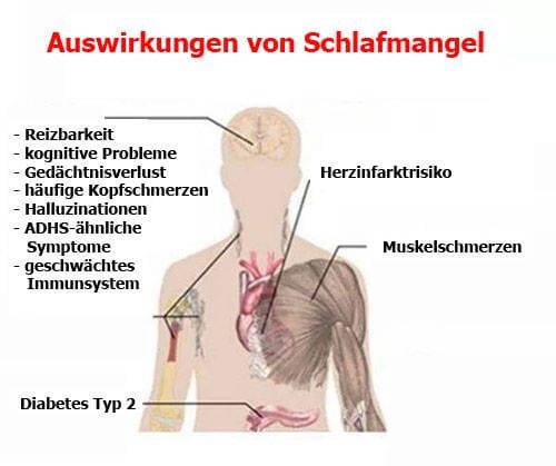 Folgen Von Schlafmangel Alles Wissenswerte Besser Gesund Leben