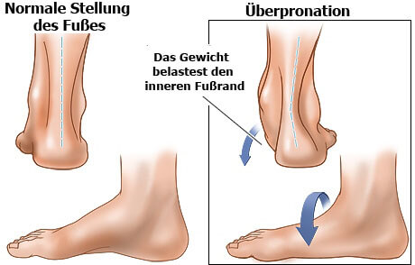 Für die Fersen schädliche Gewohnheiten Für die Fersen schädliche Gewohnheiten