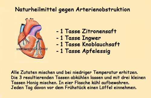 Gesundheitsrisiko Arterienverstopfung Gesundheitsrisiko Arterienverstopfung
