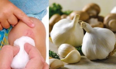 8 ausgezeichnete Antiseptika für die Haut