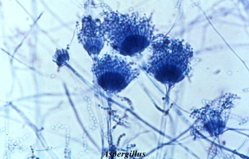 schimmel-Aspergillus