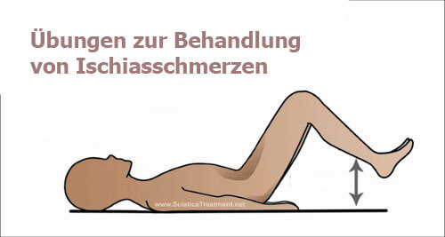 übungen-ischiasschmerzen