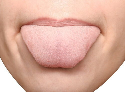 Was deine Zunge über deine Gesundheit verrät