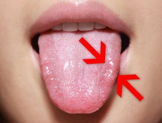 Pilzinfektionen: 9 Naturheilmittel gegen Kandidose