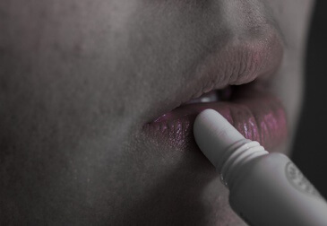 trockene_Lippen
