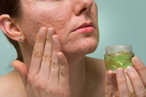Aloe_Vera_Haut