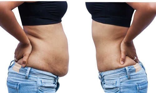 8 Gründe für Bauchfett 8 Gründe für Bauchfett