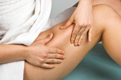 Cellulite