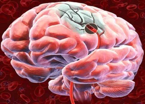 Entdecke 5 Möglichkeiten, um die Durchblutung des Gehirns zu verbessern