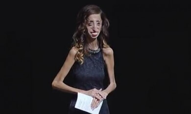 Lizzie-Velasquez