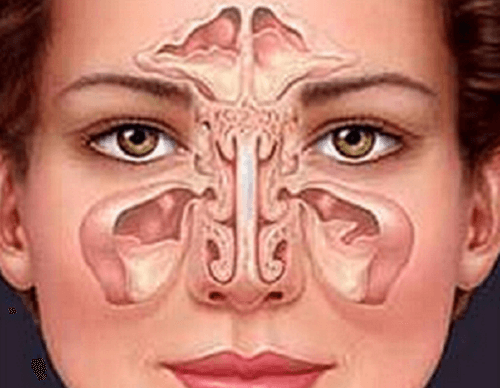 Die Nasennebenhöhlenentzündung: Entstehung, Symptome und Diagnose