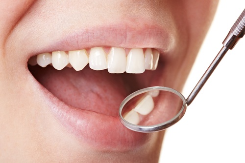 Wie man Zahnbelag daheim auf einfache Art entfernt