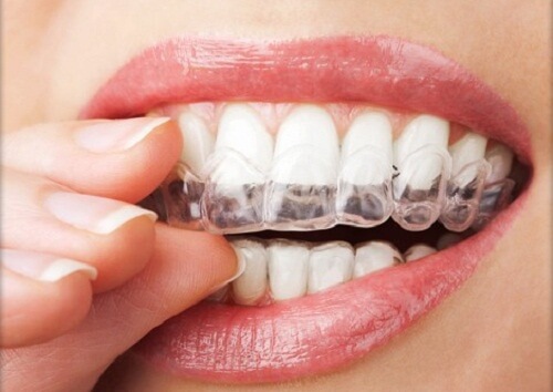4 Tipps, die gegen Zähneknirschen helfen könnten