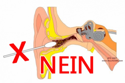 Entfernung von Ohrenschmalz