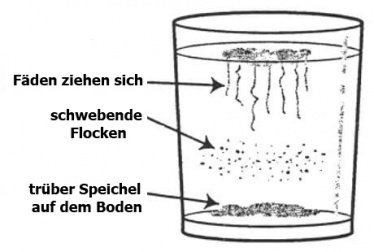 Ein Hausmittel zum ersten Nachweis von Candida und was helfen kann