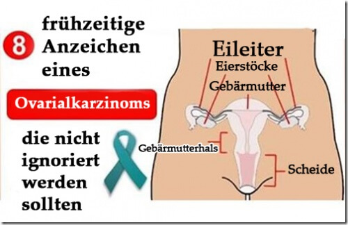 Eierstockkrebs