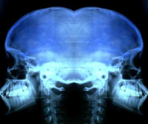 Roentgen