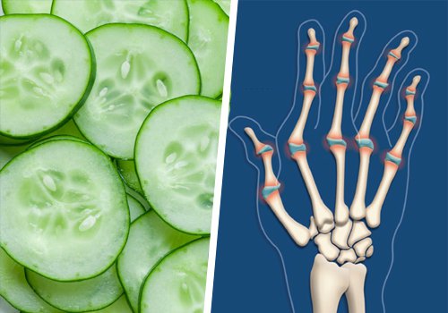 Gurken gegen Arthritis