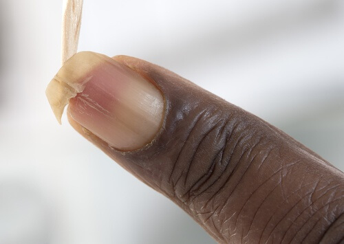 Wie brüchige Nägel gestärkt werden können Wie brüchige Nägel gestärkt werden können