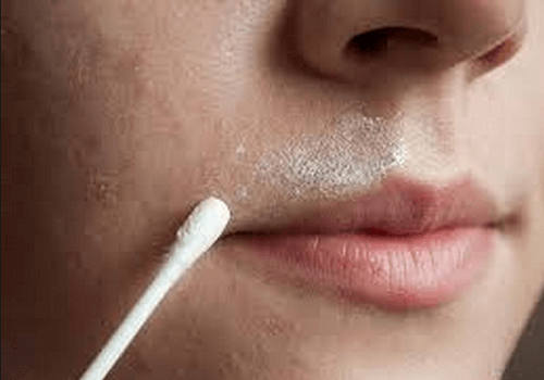Hausmittel Gegen Gesichtsbehaarung Besser Gesund Leben