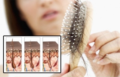 Haarausfall durch Stress: Entdecke diese ätherischen Öle
