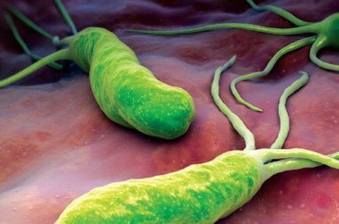 Helicobacter Pylori: Wie kann man Sodbrennen, Blähungen oder Durchfall behandeln?