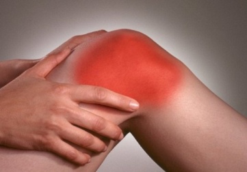 4 Heilmittel aus der Natur gegen schmerzhafte Arthritis