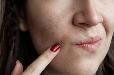 7 Beauty-Sünden, die der Haut schaden