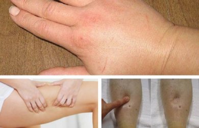 8 natürliche Diuretika, die bei Flüssigkeitsretention helfen
