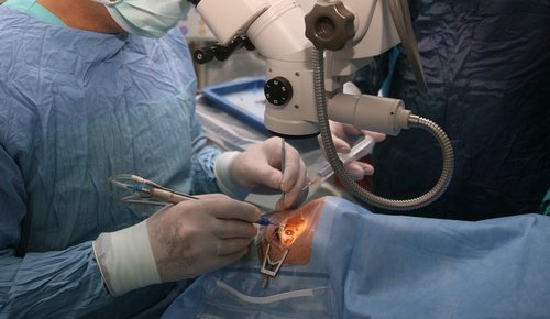Augen-Operation mit bionischer Linse