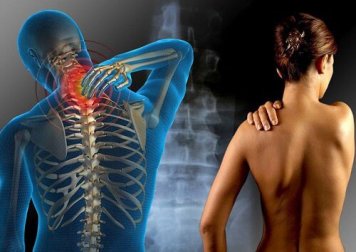 Fibromyalgie: Muskelschmerzen und Müdigkeit