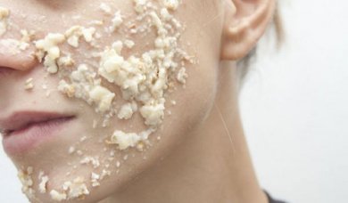 Endlich Schluss mit Pickeln und Akne dank dieser Maske aus Hafer und Milch