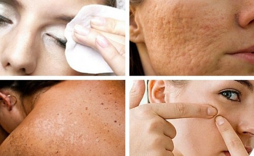 7 Angewohnheiten, die deiner Haut schaden – und die du leicht vermeiden kannst