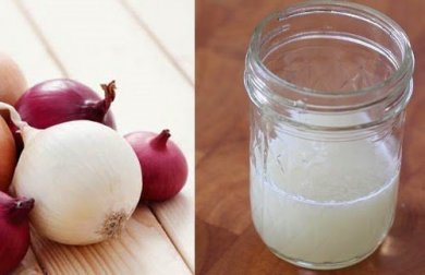 Zwiebelkur gegen Haarausfall