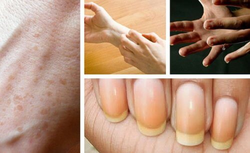 9 Dinge, die deine Hände über deine Gesundheit verraten