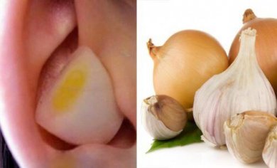 Knoblauch und Zwiebel im Ohr wirken Wunder