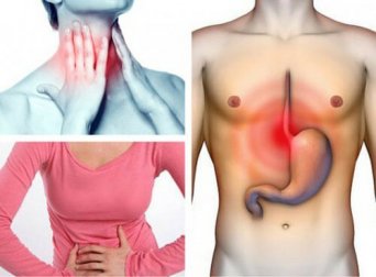 Symptome und Behandlungsmöglichkeiten von Refluxösophagitis
