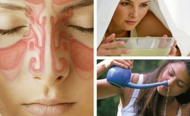 Sinusitis bei Erkältung: 9 Hausmittel, die helfen können