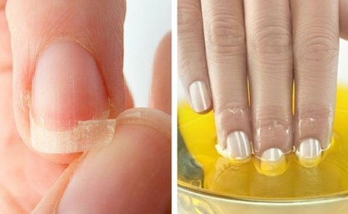 Naturlich Schone Fingernagel Die Besten Tipps Besser Gesund Leben