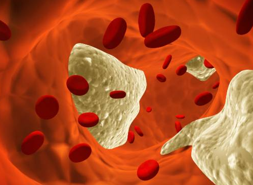 Cholesterin-im-Blut