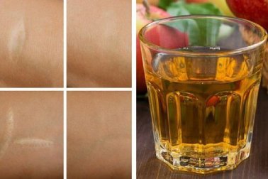 Antioxidatives Gesichtswasser gegen Falten, Narben und Sonnenbrand