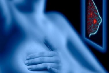 Mammographie: Fluch oder Segen?