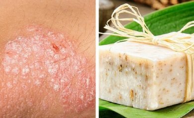 Selbstgemachte Seife zur Behandlung von Ekzemen der Haut