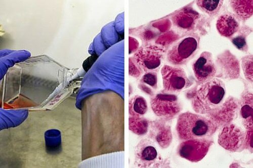 Wissenschaftler entdecken wie sich Leukämiezellen selbst zerstören können
