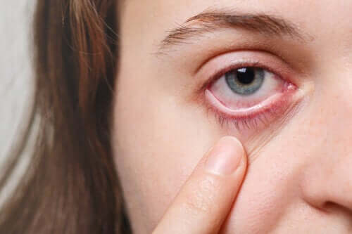 Das trockene Auge-Syndrom: 5 hilfreiche Tipps